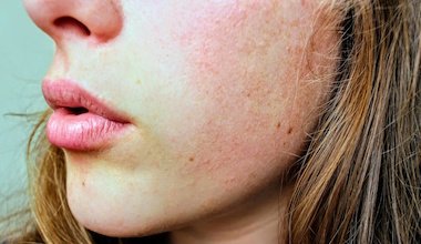 Odos priežiūros klaidos