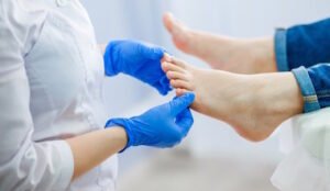 Nagų grybelio pirmieji požymiai